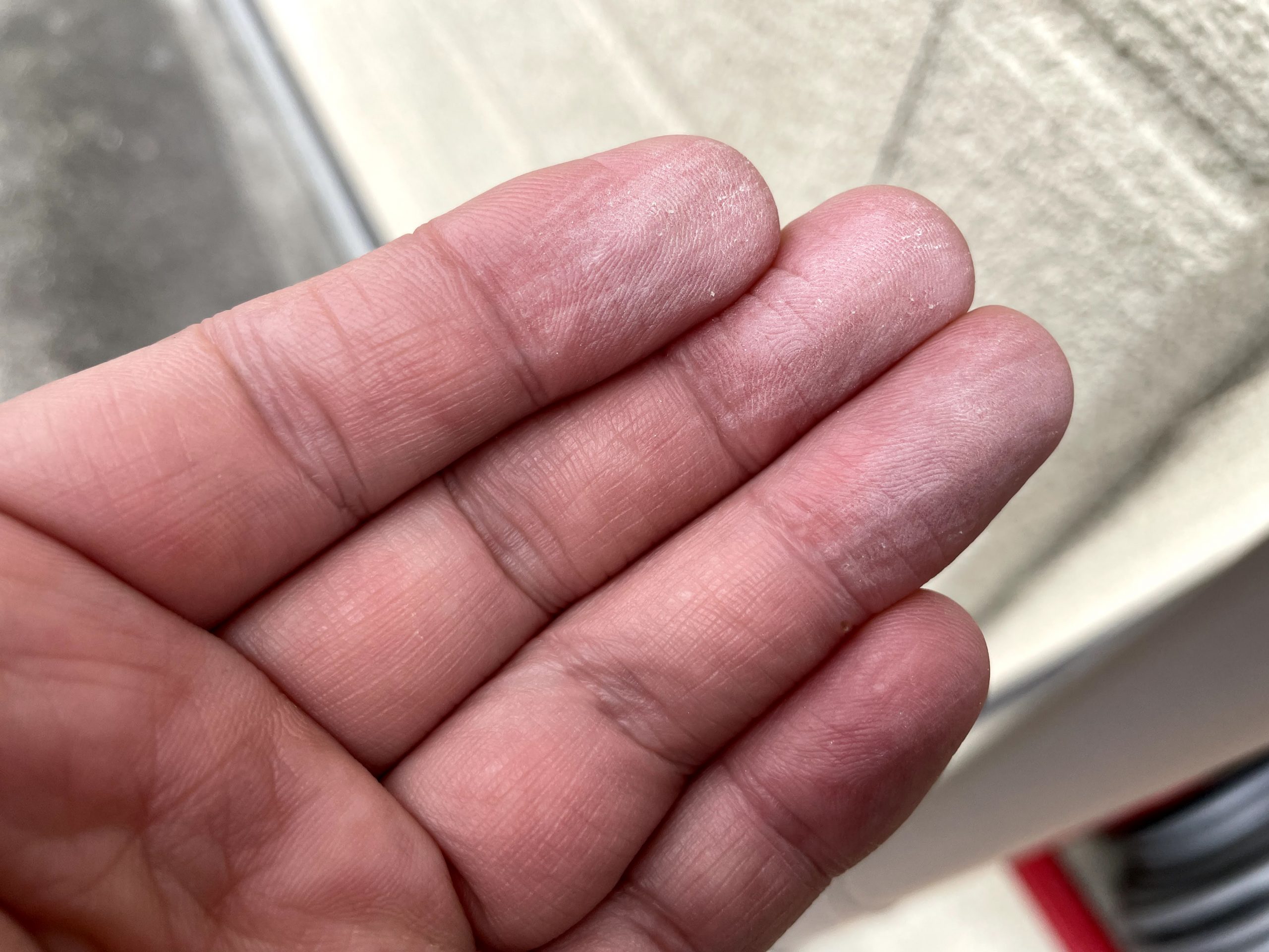 手に白い粉が付着している状態